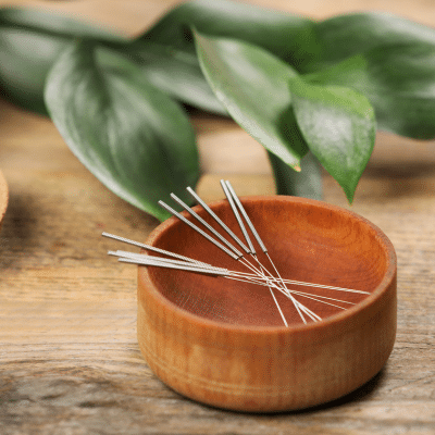 acupunture in oakville