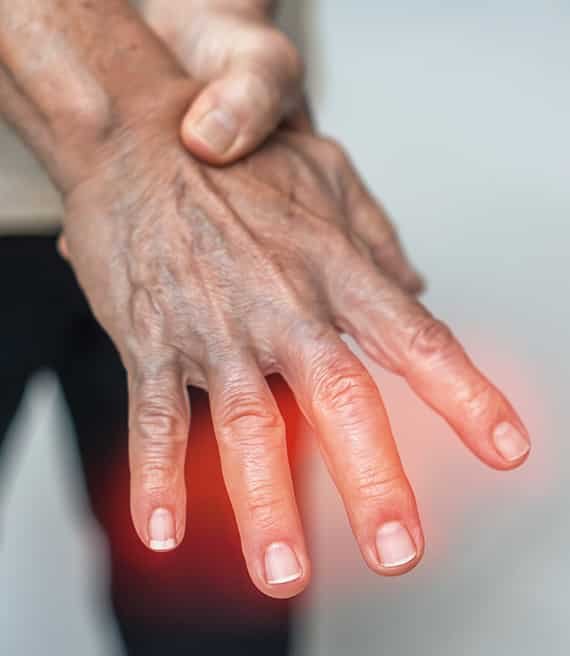 arthritis finger pain
