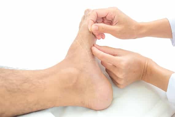 plantar faciitis acupuncture treatment