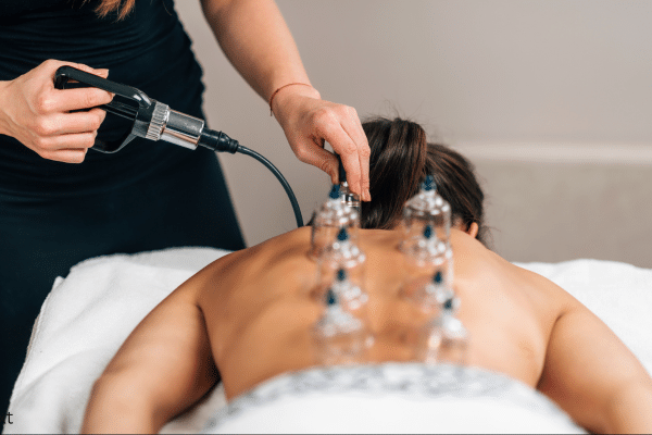 cupping therapy at oakville